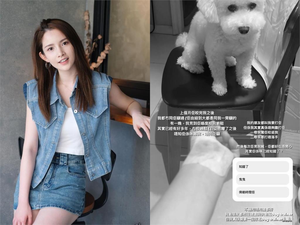 甜美女星遭狗咬「滿地都是血」驚悚畫面曝光…她因「這理由」超自責：很灰心