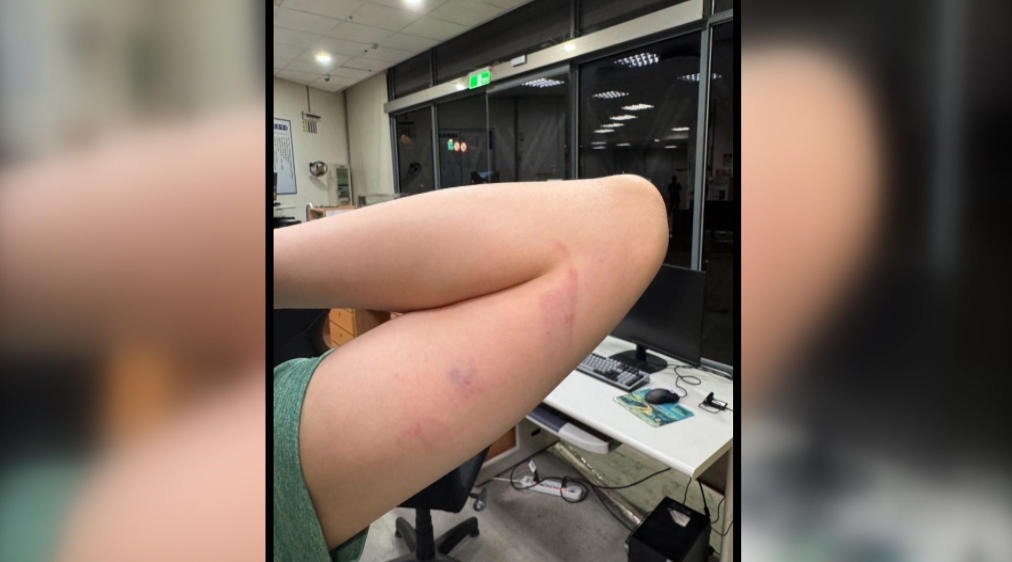 又見醫療暴力!三護理師阻病人下床 遭毆打「眼鏡碎裂」