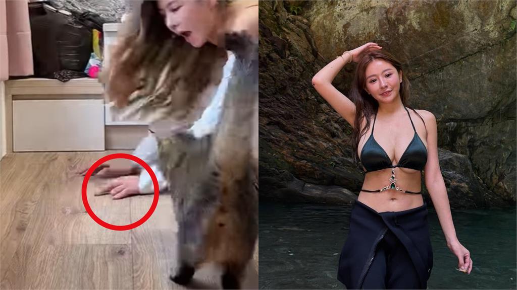 53萬網紅「護理系女神」驚傳國外猝逝!生前自曝「斷指秘辛」:打玻尿酸還比較痛