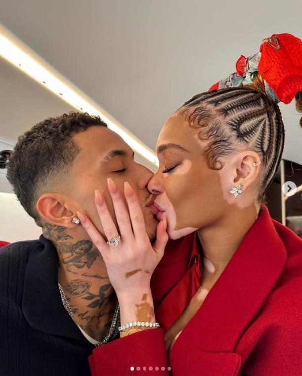 NBA/公鹿前鋒Kuzma宣布求婚成功! 加拿大「白蝕症」名模飛機上點頭答應