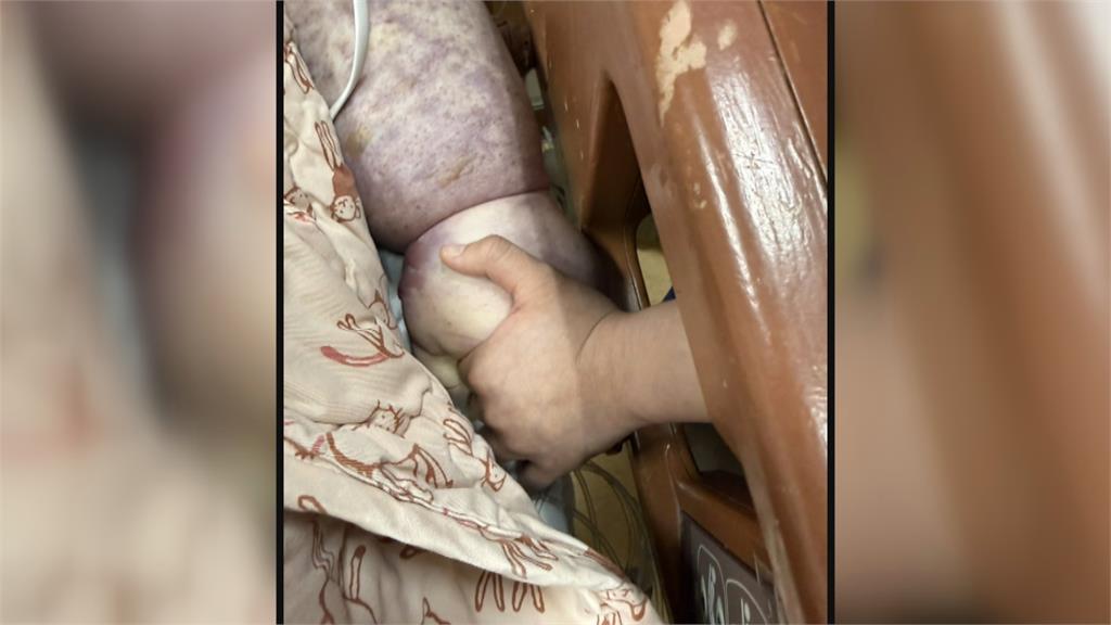 體育女教師「減重手術」後身亡　醫療疏失？醫師暫停醫療業務