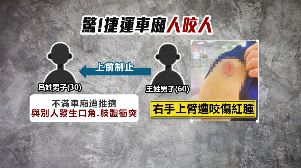 不滿車廂遭推擠扭打! 好心男勸架「反被咬」傷勢曝光