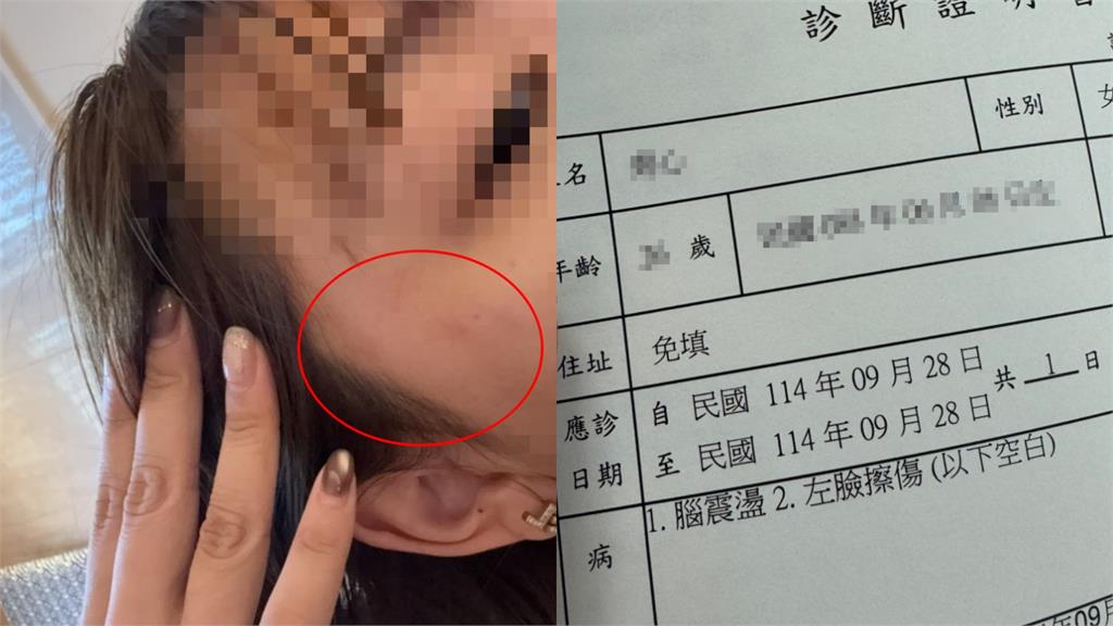 信義區台港7男女電梯口開戰！網紅遭「扯髮、甩巴掌腦震盪」淚喊：第一次被侮辱