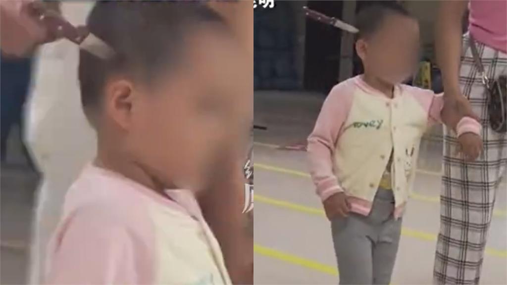 中國女童「頭插水果刀」進醫院不哭不鬧 網見畫面批:家長讓她自己走?