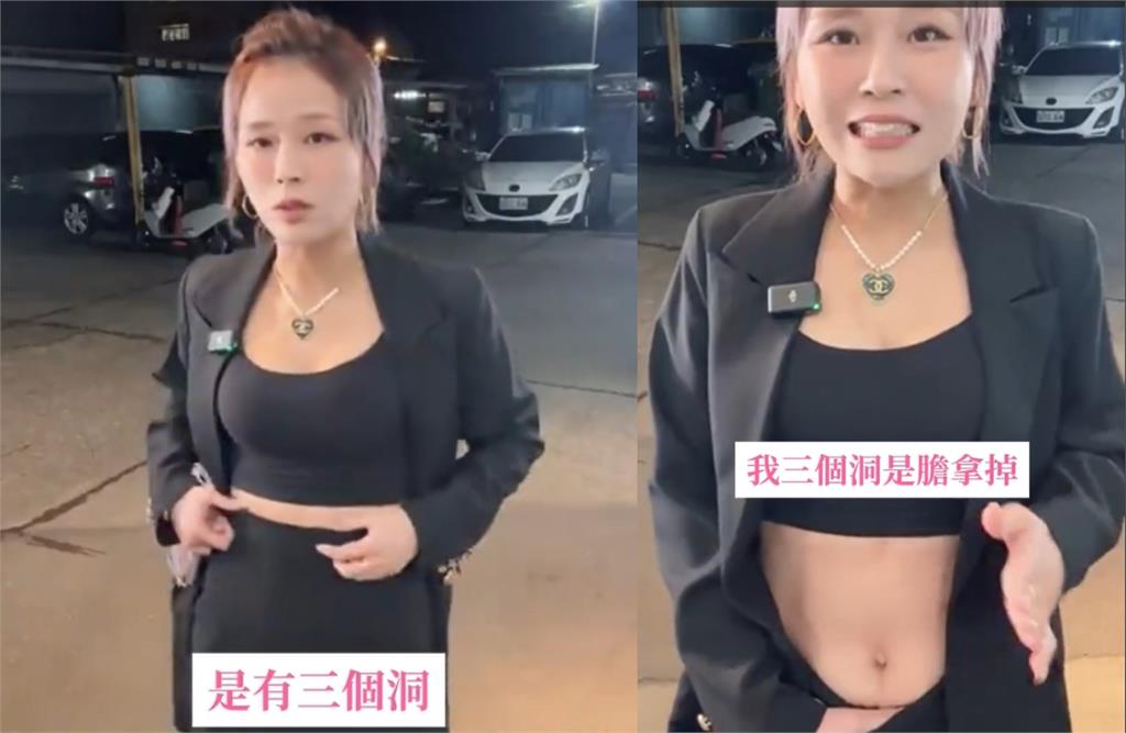 丟丟妹「93→46KG」被瘋傳切胃減肥!掀衣認了「肚子挖3洞」餓到睡不著