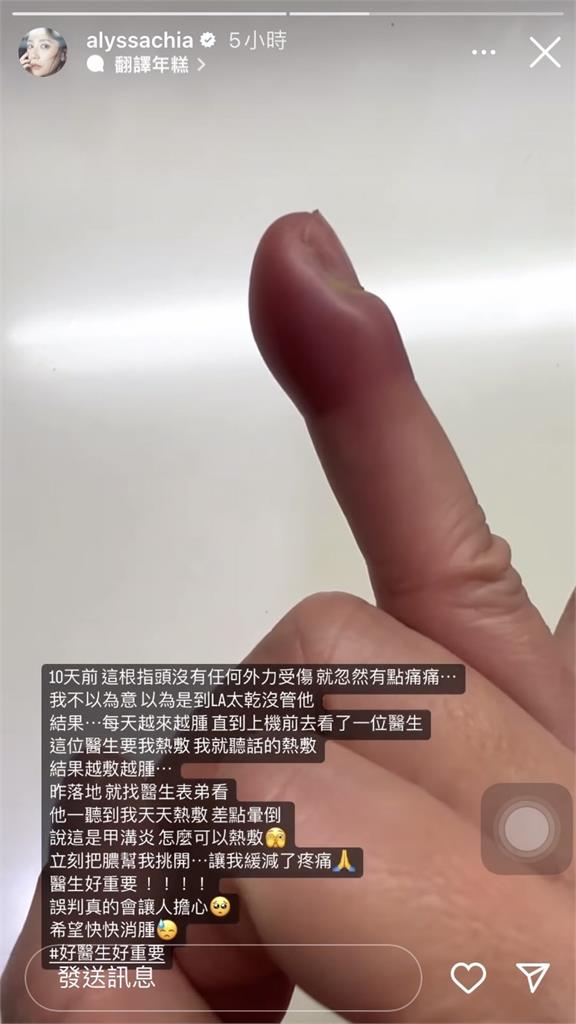 賈靜雯在美國驚傳意外!被誤診「這裡化膿」她崩潰大喊5字