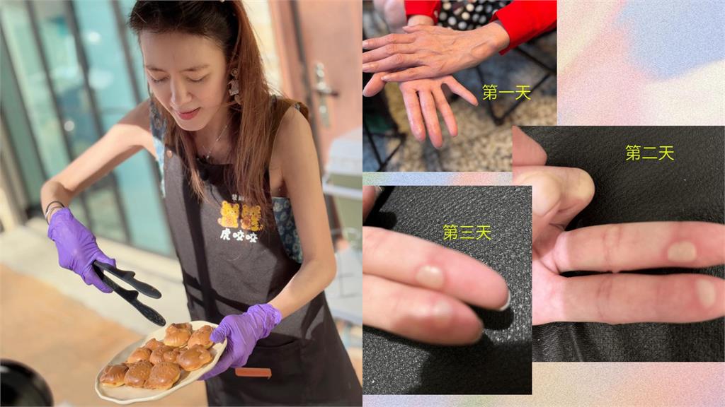 裴琳斜槓開店賣雞蛋糕！她見「舊事被重提」怒喊：20年了能放過嗎？