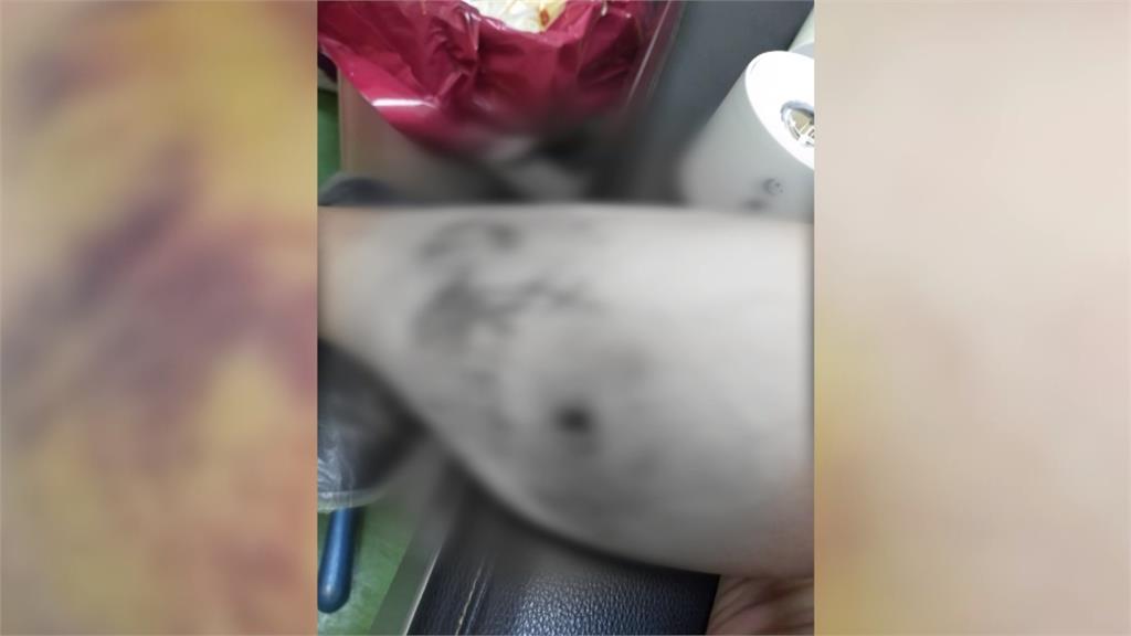 嚇人！彰化和美１５隻惡犬遊蕩　民眾遭追咬事件頻傳