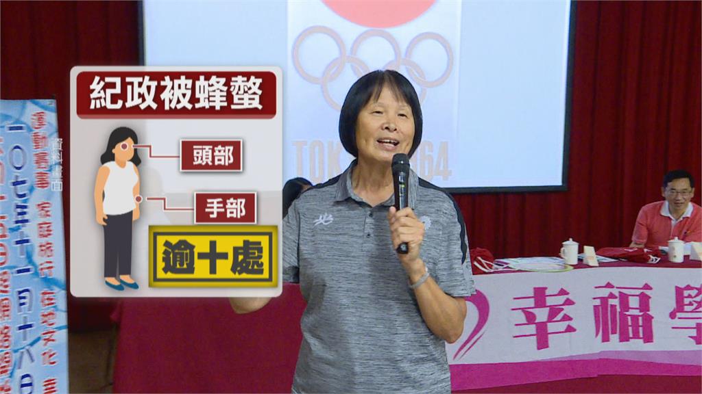 驚！日前遭黑腹虎頭蜂群攻　紀政頭、手多處螫傷