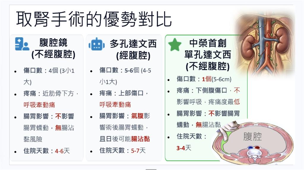 鶼鰈情深！不捨尪洗腎受苦　妻「達文西手術」捐腎救夫大成功
