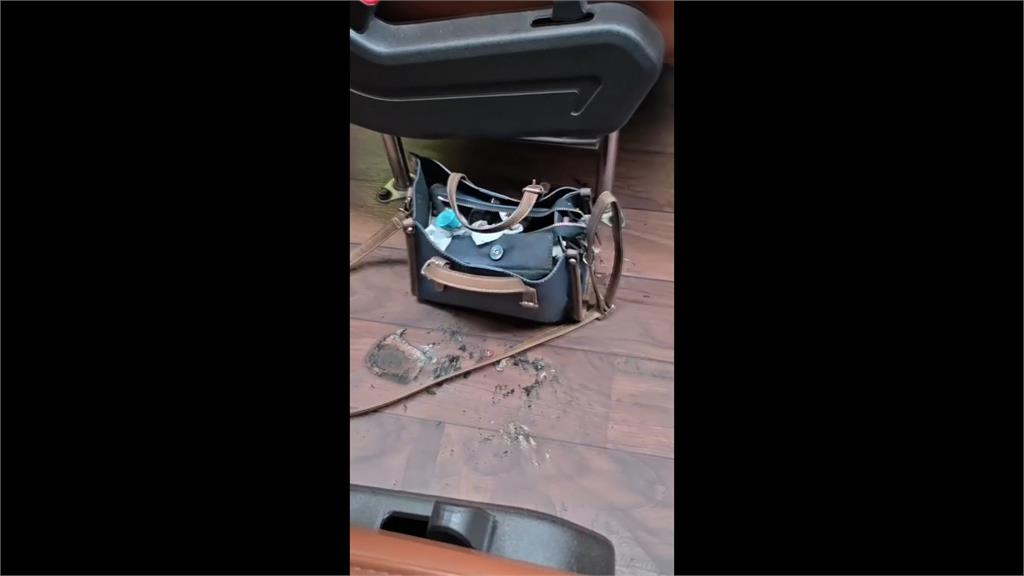 行動電源突自燃! 民眾臉部.頭髮遭殃險燒到護照