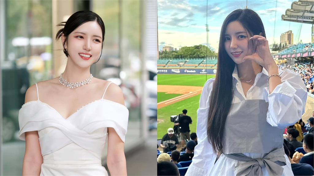「台妹小南」突受傷!雪白嫩腿驚見「2大片瘀青」…65字心境全說了