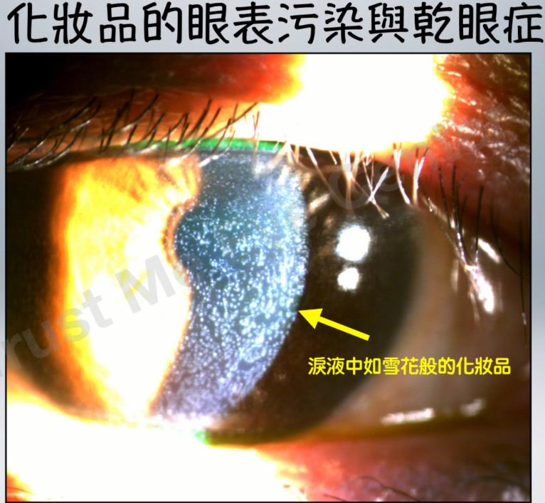 化妝竟成「乾眼」元兇?醫師揭隱藏危機 提醒女性避免「眼妝地雷」