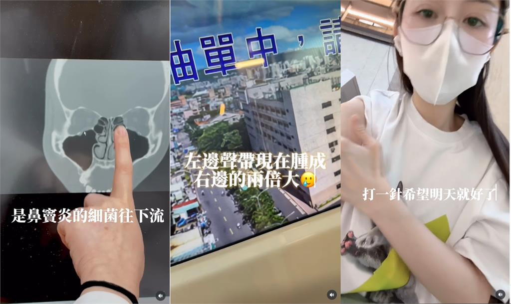 Albee「猛灌超鹹鹽水」出大事!全場竟歪樓「緊盯炸裂1幕」:生病還有福利…
