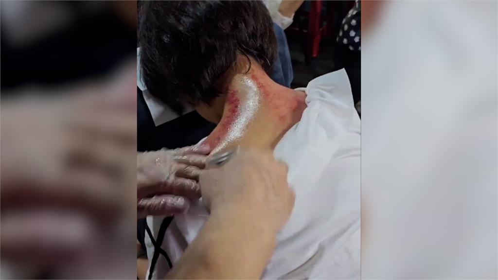 游淑慧遭架脖子畫面曝光 網友見「兩道血痕」驚呆