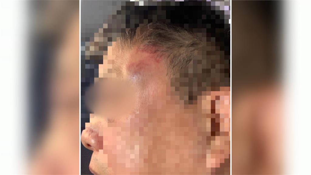 質疑吃完肚子痛爆口角 男毆打豆花攤販