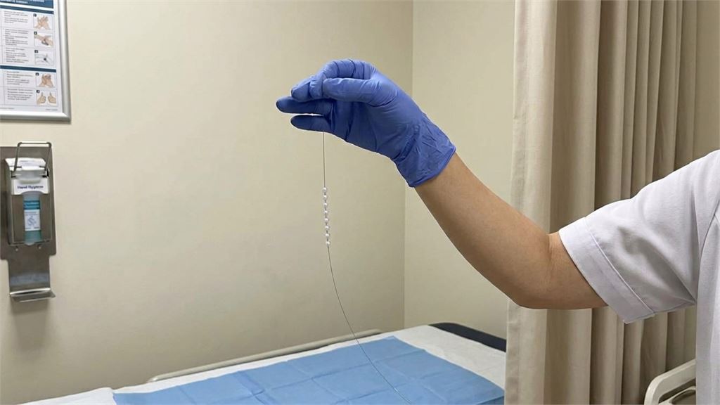 男子興起將「24顆珠子塞進尿道」！醫生檢查驚見「18公分珠鍊」已…下場曝光