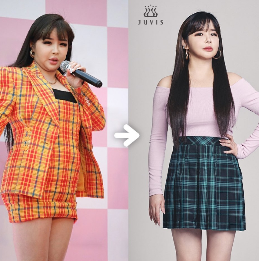 2NE1朴春自拍「辣露猛料」!浮誇妝容又變臉「髮際線退潮」網心疼