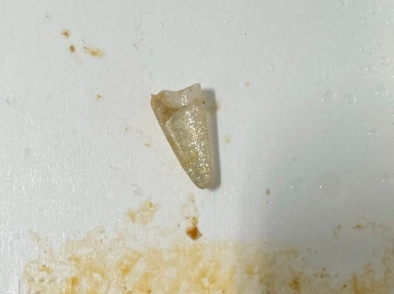 噁心加料!黃燜雞米飯驚見「水晶指甲」 民眾險吞下肚