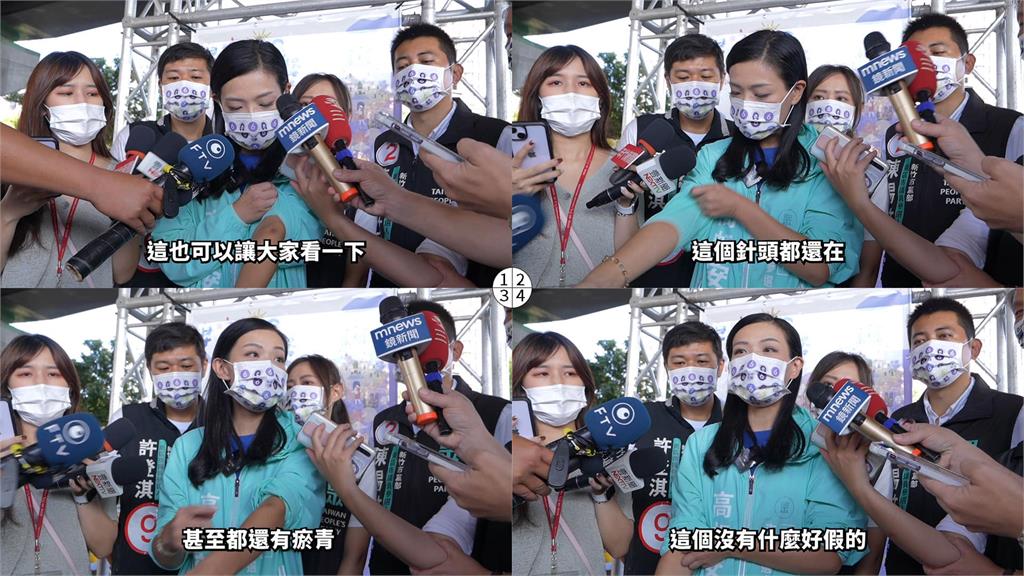演很大?高虹安右手打點滴秀「左手淤青」 苦苓:又創造一個奇蹟