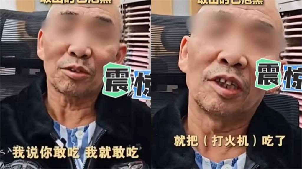 67歲老翁胃裡藏「30年前打火機」肚子爆痛！醫靠「1害羞小物」取出竟還能點火