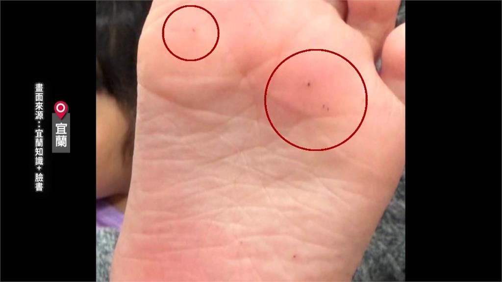 宜蘭童玩節"釘針扎腳" 花蓮造浪池漂塑膠片險割眼