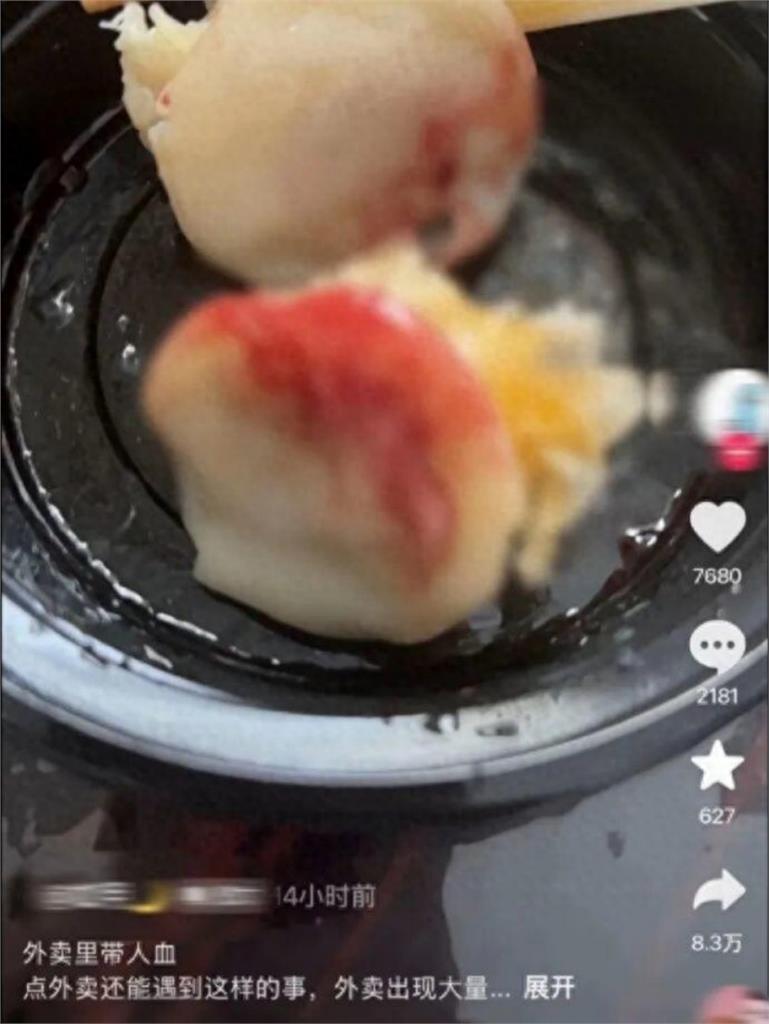 外送點小吃店燒賣竟「吃到大量人血」！他嚇到衝醫院檢查…驚悚畫面曝光