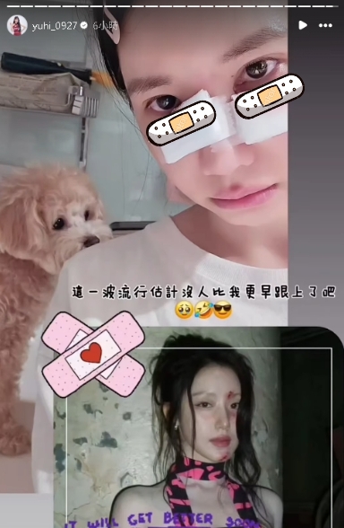 樂天女孩驚傳被狗咬傷 滲血畫面嚇壞粉絲 樂天女孩遭「愛犬咬破相」急送醫!「眼下血狂流」畫面曝光…她嘆:恐無法上班