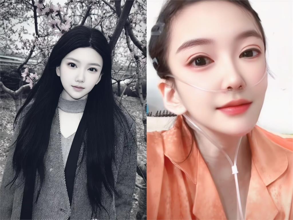 中國網紅不敵病魔逝世…曾悲喊「不想堅持了」　前夫不離不棄守到最後