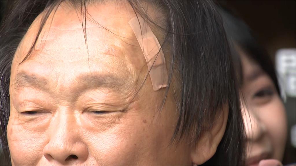 王世堅帶傷質詢額頭貼OK繃 親揭真凶:我還跟牠們道歉