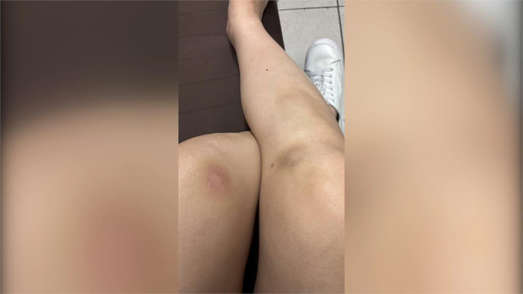電動車騎士控遛狗不牽繩 行車中遭邊牧撲倒 雙腿瘀青機車毀損