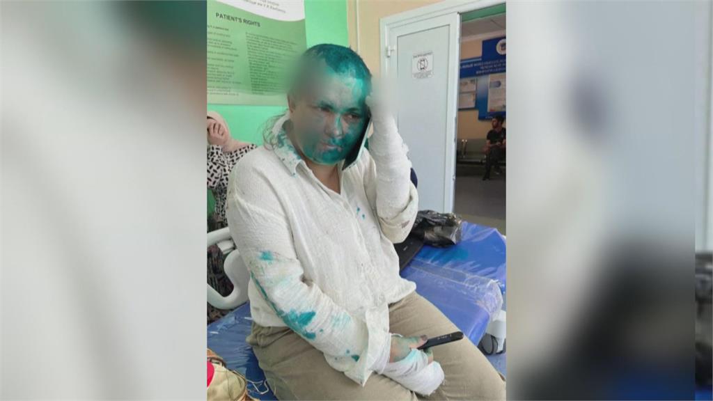 頭髮剃光、臉潑漆、打斷手指　俄羅斯記者車臣遇襲