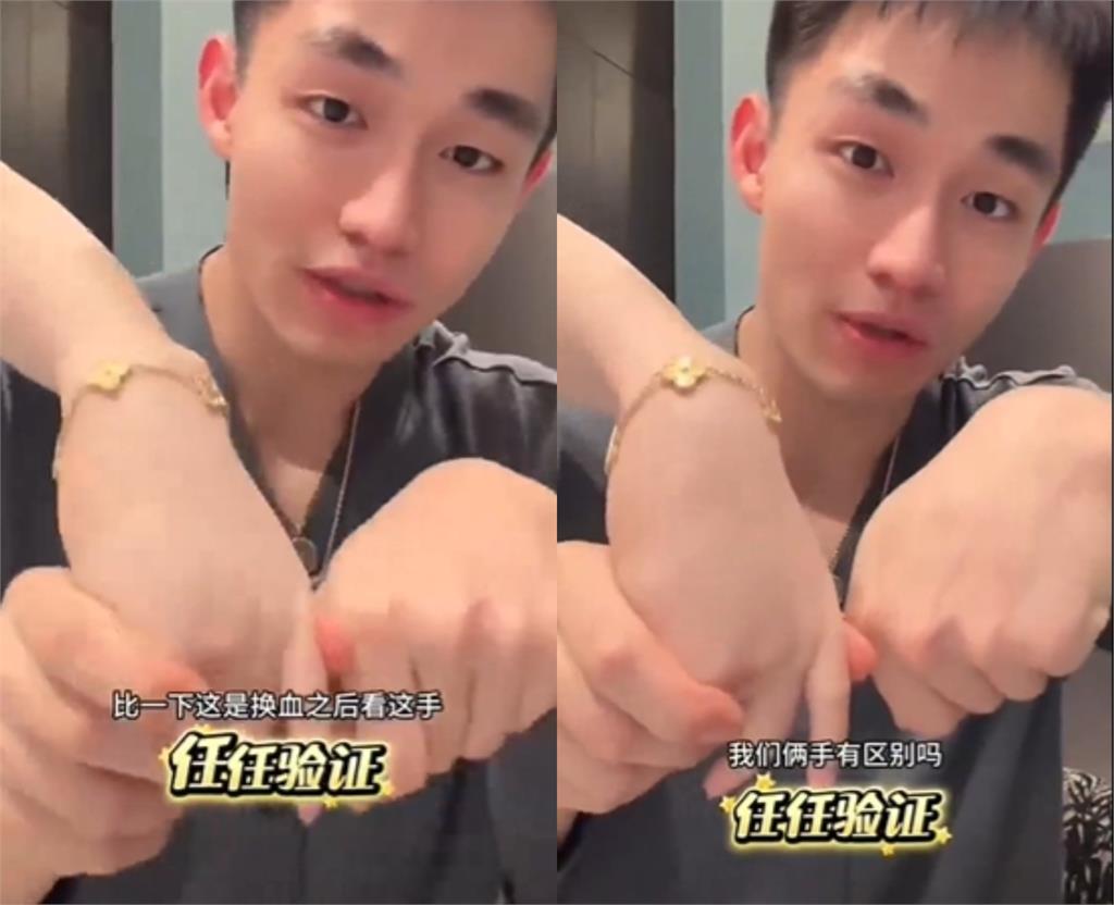 55歲中國大媽「皮膚回春」畫面曝光!25歲男友揭「換血秘辛」:會長新皮膚