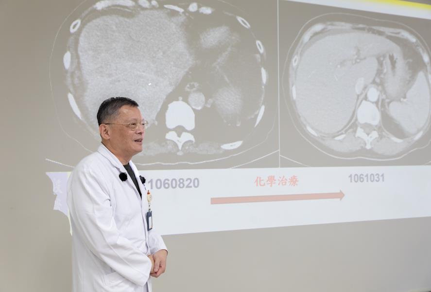 奇蹟!婦人「數百顆腫瘤」兩個月全消 陽交大醫院逆轉生機