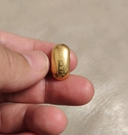 11歲男童稱練舌力誤吞「10克金豆」 媽氣炸:不准在外面上廁所!