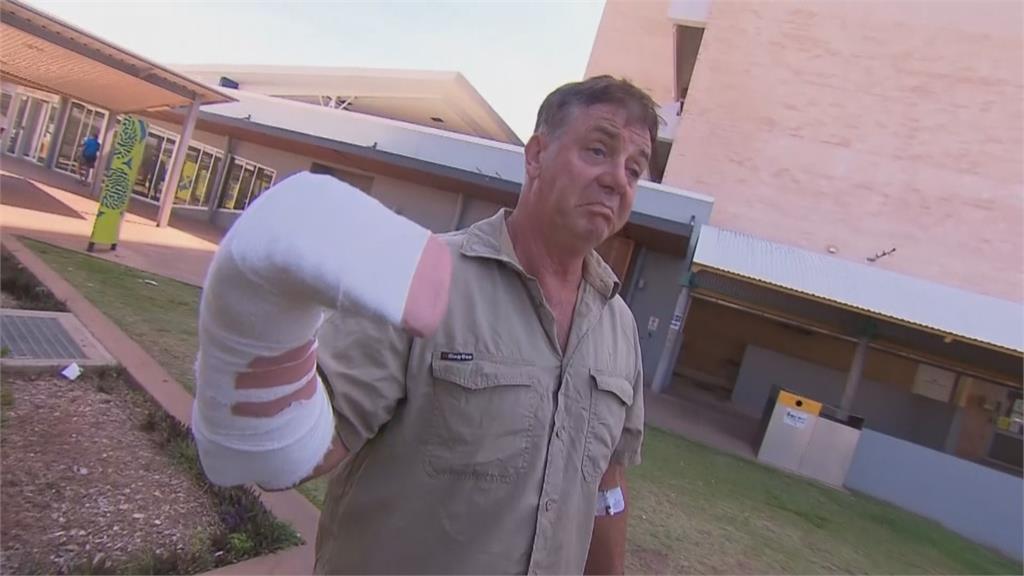 餵食失誤！　澳洲阿德萊德河60歲動物導覽員遭咬傷
