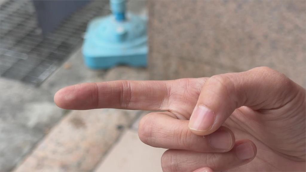 傻眼！　電信門市辦業務　　女店長激動開口咬傷顧客手指