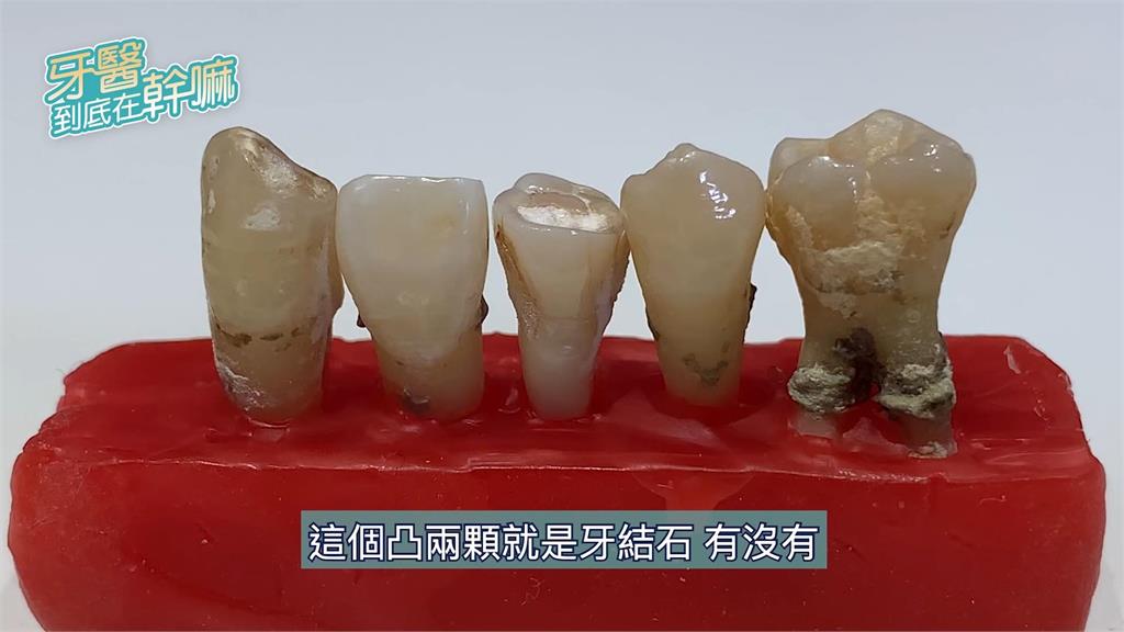 好害羞!帥醫親手教「私密處」怎麼洗 提醒:流血不要怕牙越刷越健康