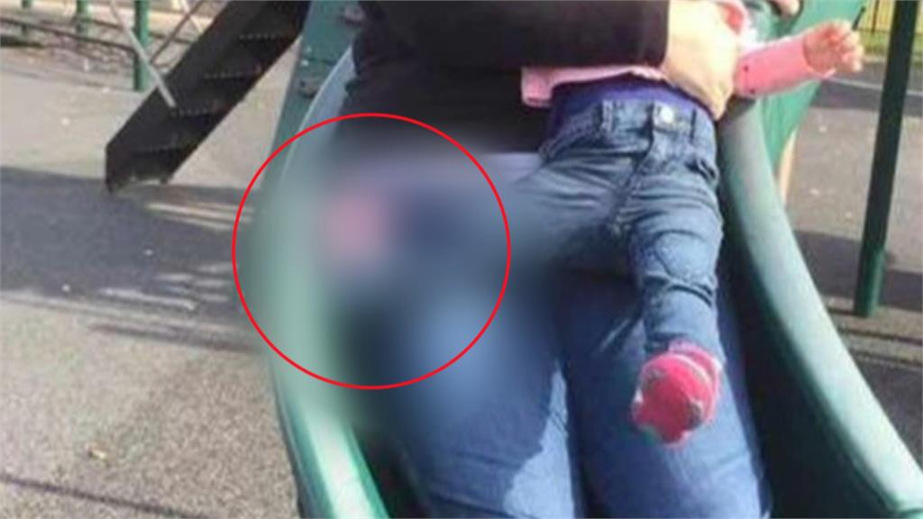 溜滑梯「這舉動」超危險! 醫師:一不小心就骨折