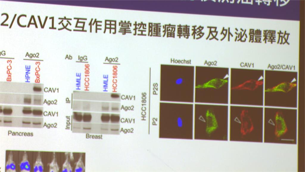 乳癌患者福音！「外泌體」可偵測癌細胞轉移　加速修復人體組織再生