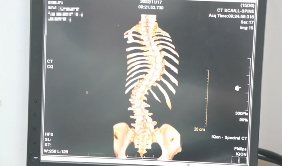 台中榮總傳「讓無照廠商動刀」！醫師納涼喊「會痛要講」受害者破180人