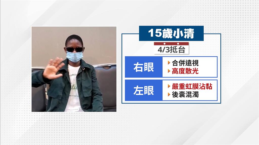 史瓦帝尼友邦15歲少年來台治眼疾 視力0.1順利恢復至0.7