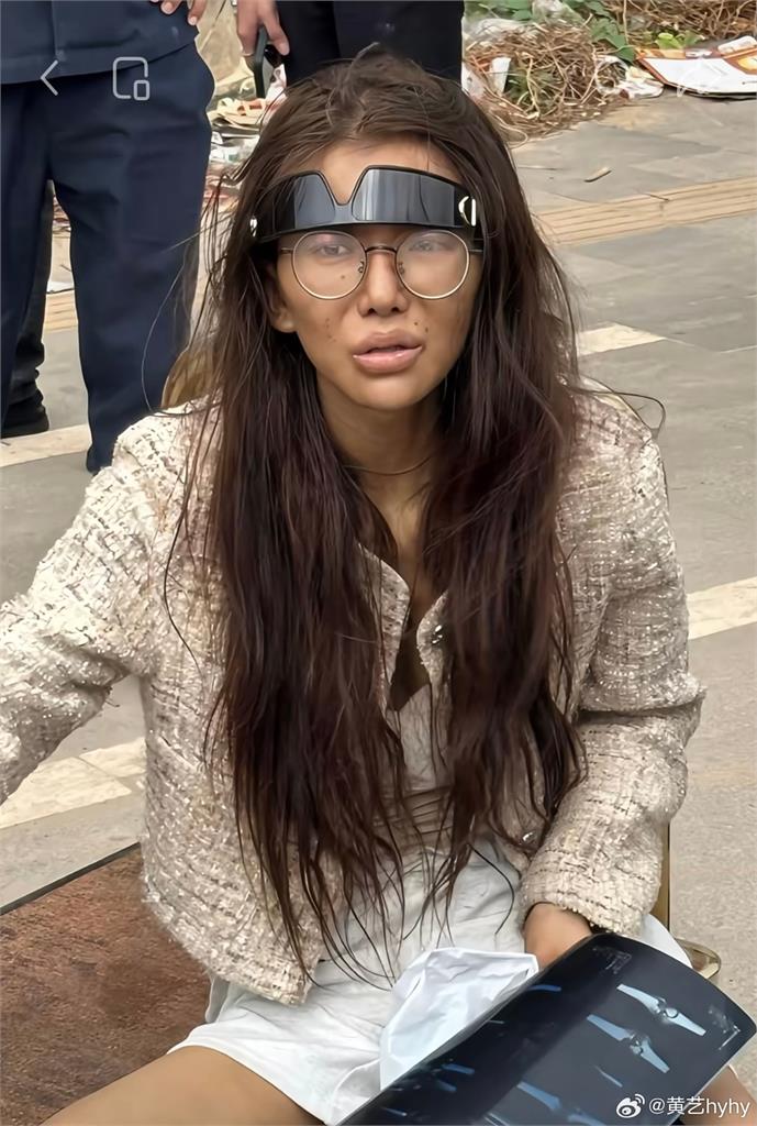 20歲女網紅遭斷腿丟包柬埔寨！網見她吃「八寶粥」曝暗黑內幕：牙被拔光