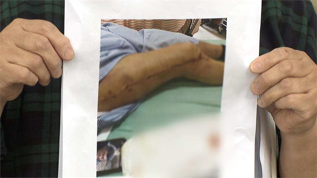 ７１歲老翁赴國術館推拿竟「大腿骨折」　　家屬怒控業者「不聞不問」
