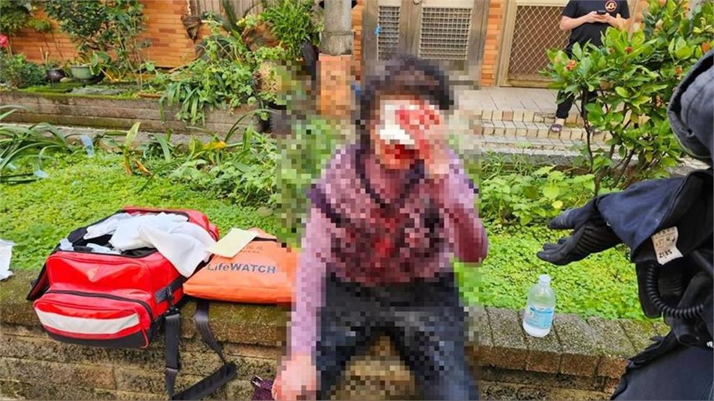 快新聞/宜蘭包裹爆炸2人傷!疑投資糾紛挾怨報復 1犯嫌落網移送地檢署