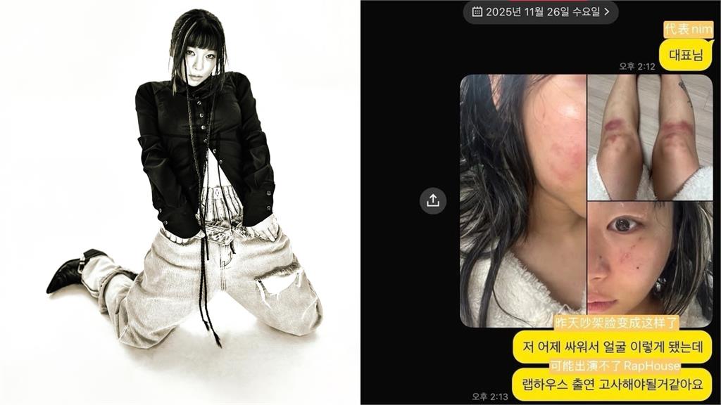 29歲南韓女星PO多張「被打瘀青照」！她控前男友「掐脖、監禁」語音曝光
