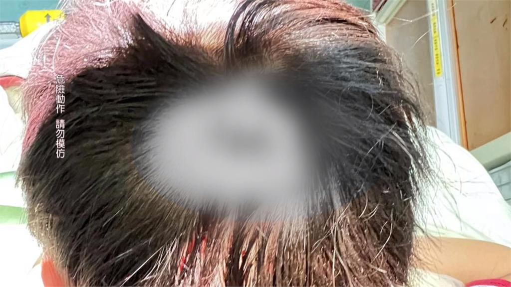 小學生遊小人國遭人丟石頭砸傷　家長控未送醫延誤處理