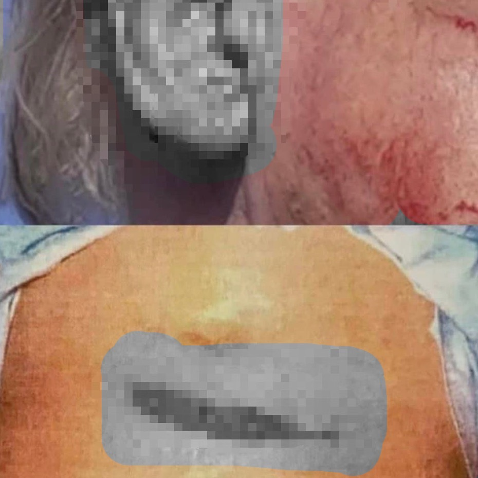 歷史觀測站／「兩顆子彈」改變局勢！319槍擊案震撼全台　 陰謀論至今仍未歇