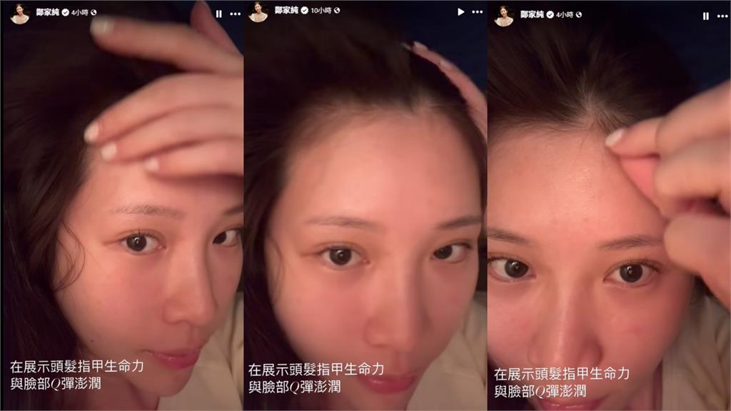 鄭家純大素顏撩髮「翻開真實髮際線」!15秒反差片流出震撼84萬粉