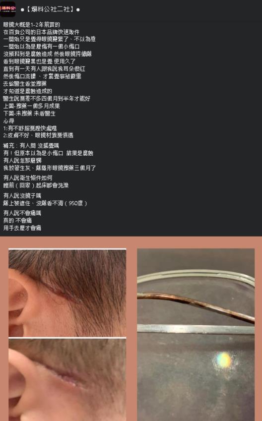 超驚悚!他戴眼鏡耳旁被腐蝕「傷口流膿」原因曝網卻不領情:太誇張